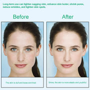 Masajeador Escultor Vibratorio con Calentamiento